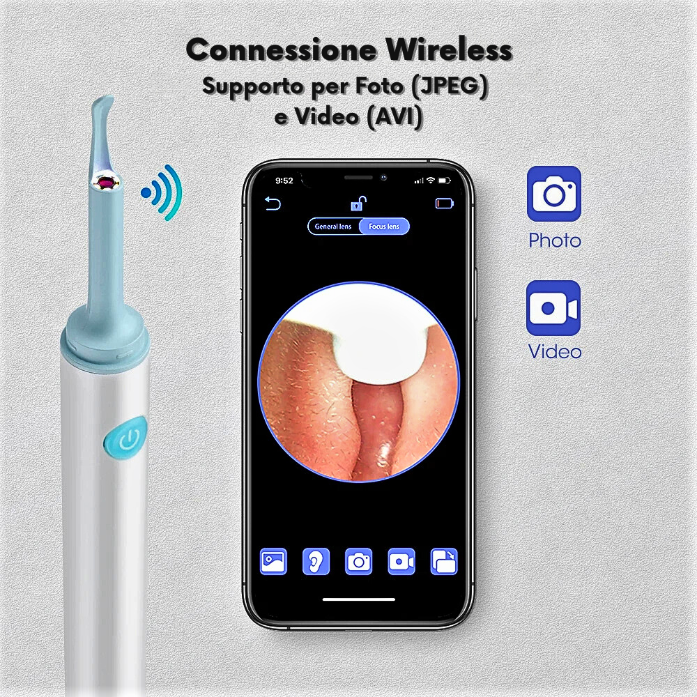 Otoscopio inteligente profesional: la nueva frontera de la higiene personal