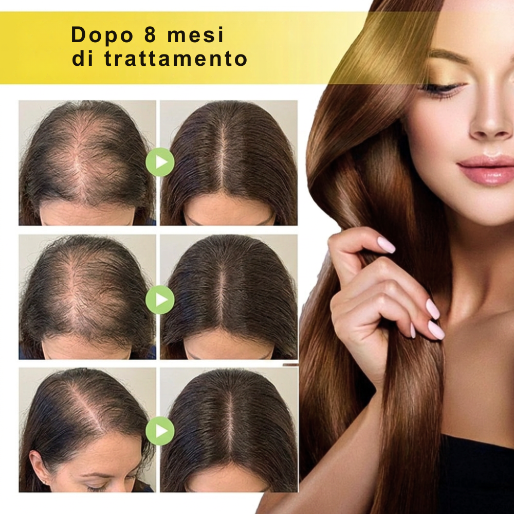 Olio di Semi di Nigella Sativa per Pelle e Capelli