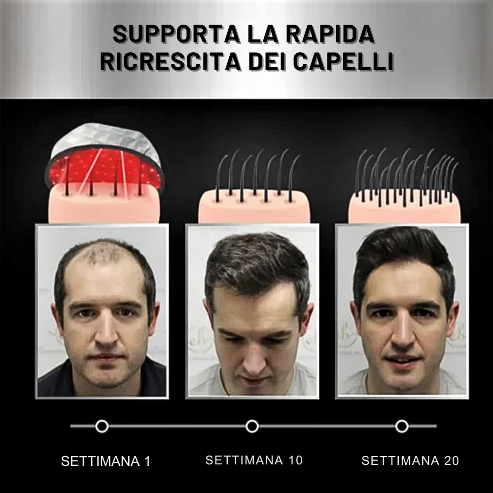 Casco Ricrescita ai LED Fotonici e Raggi Infrarossi