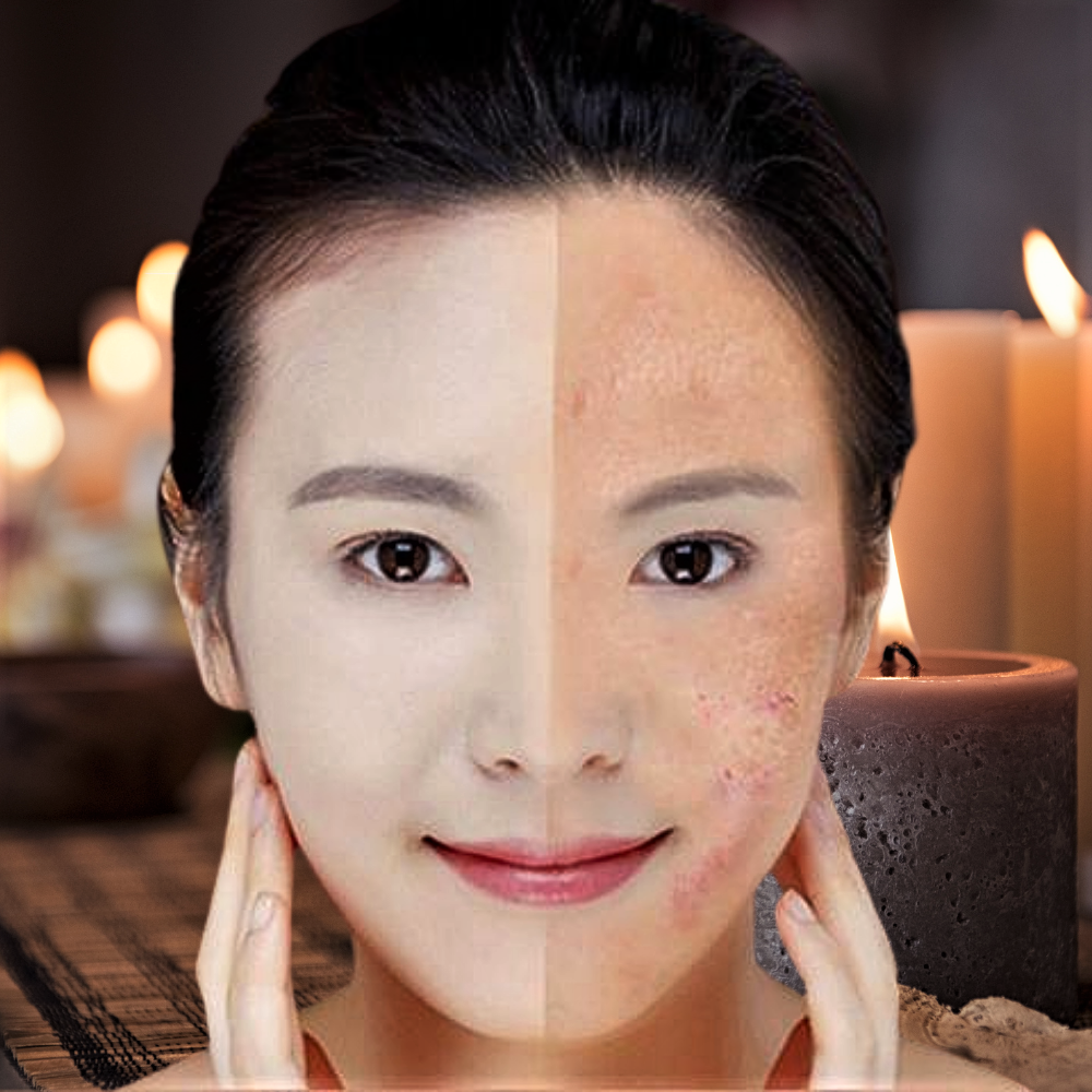 Blue Light Laser Pen: Revolutionize Your Beauty Routine and Skin Health