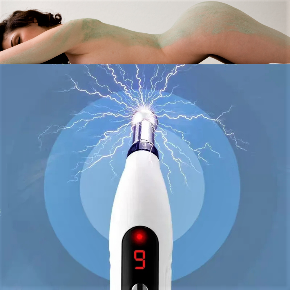 Dispositivo a Laser Freddo con Elettrostimolazione – Terapia Innovativa per il Sollievo dal Dolore