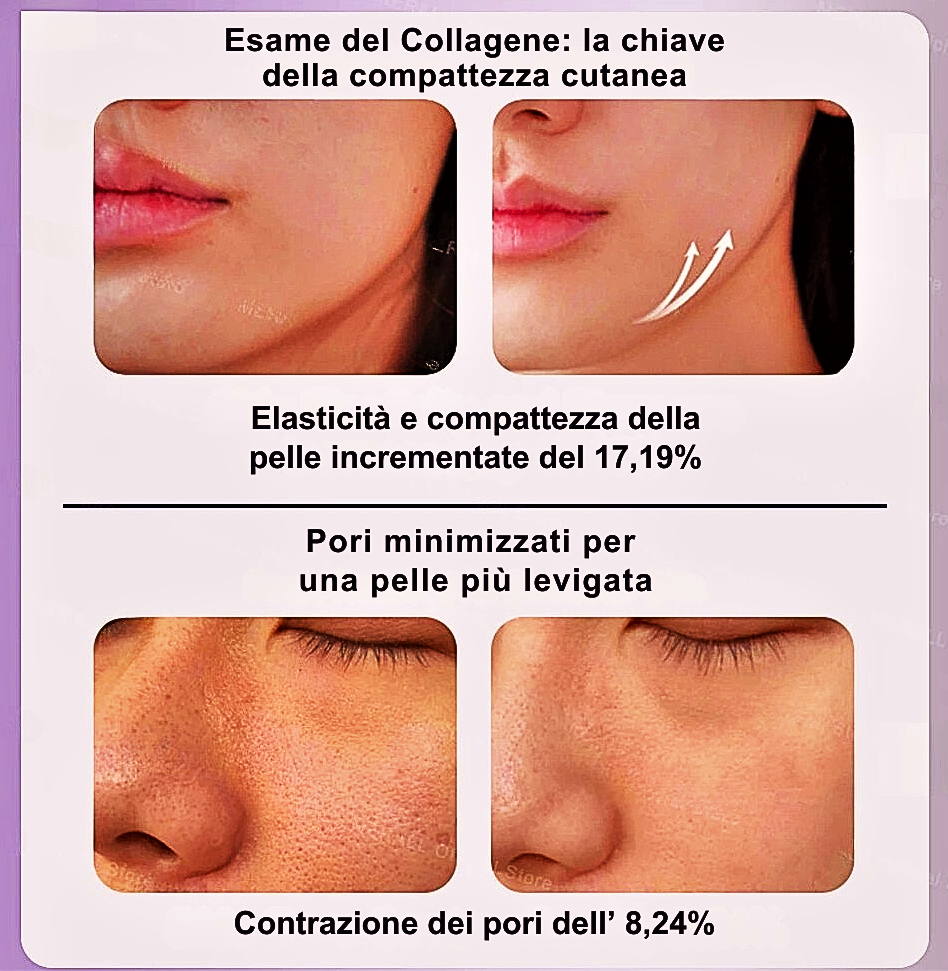 Dispositivo di Microneedling con Tripla Luce Fotonica