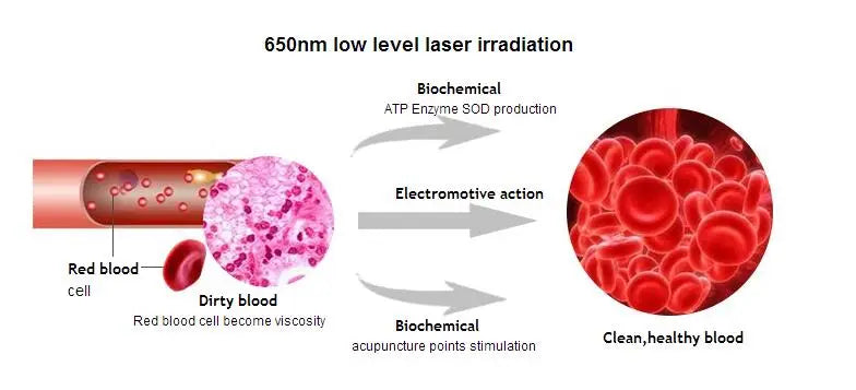650nm Laser Therapy Wrist Diode LLLT Watch Diabetes Hypertension Cholesterol Treatment Laser Physiotherapy Watch Accessories
