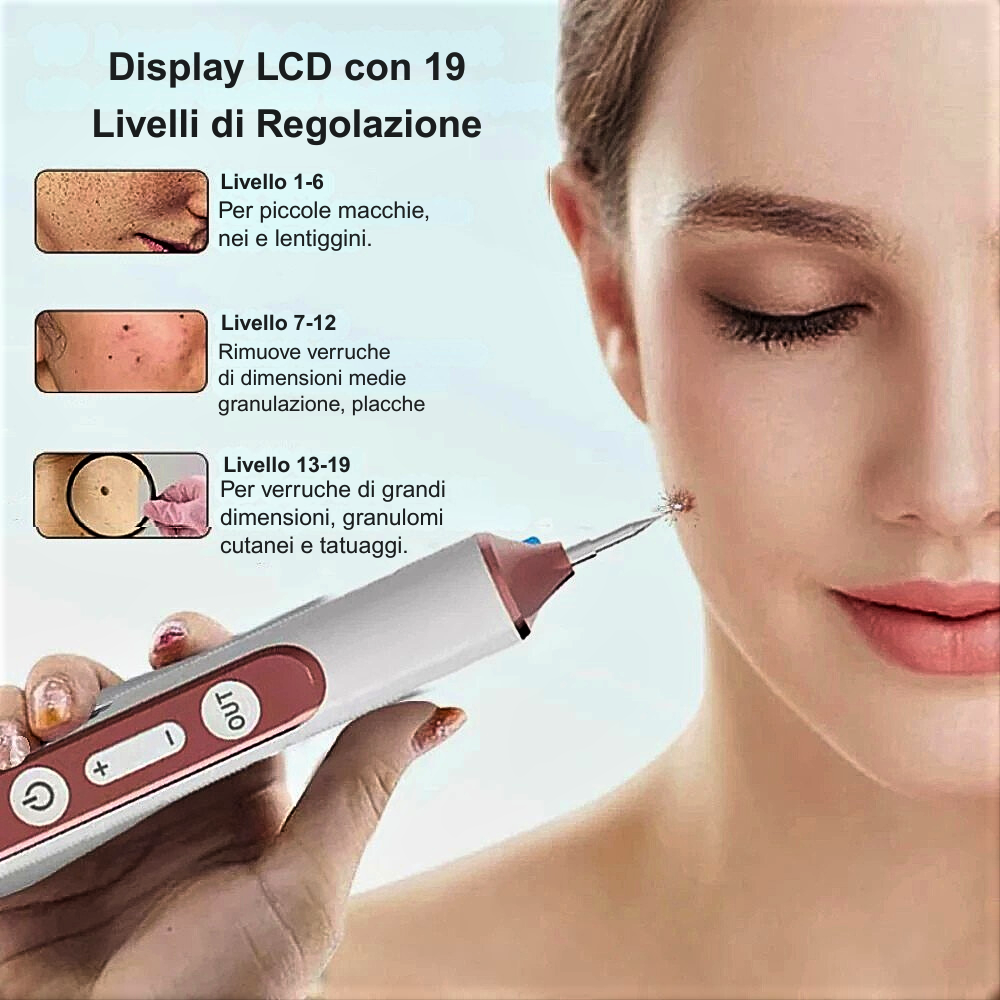 Penna Laser al Plasma – Rimozione Professionale di Imperfezioni Cutanee