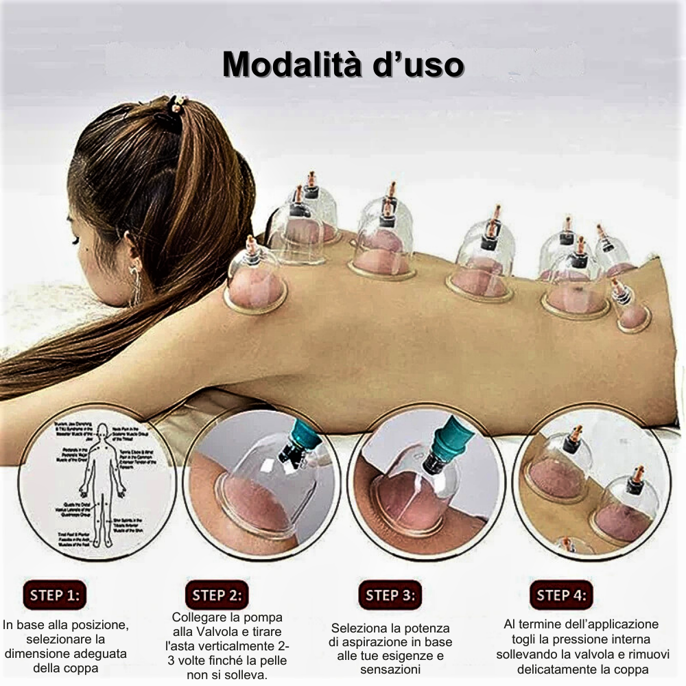 Set di Coppettazione Anti Cellulite: La Soluzione Naturale per una Pelle Più Liscia e Tonica