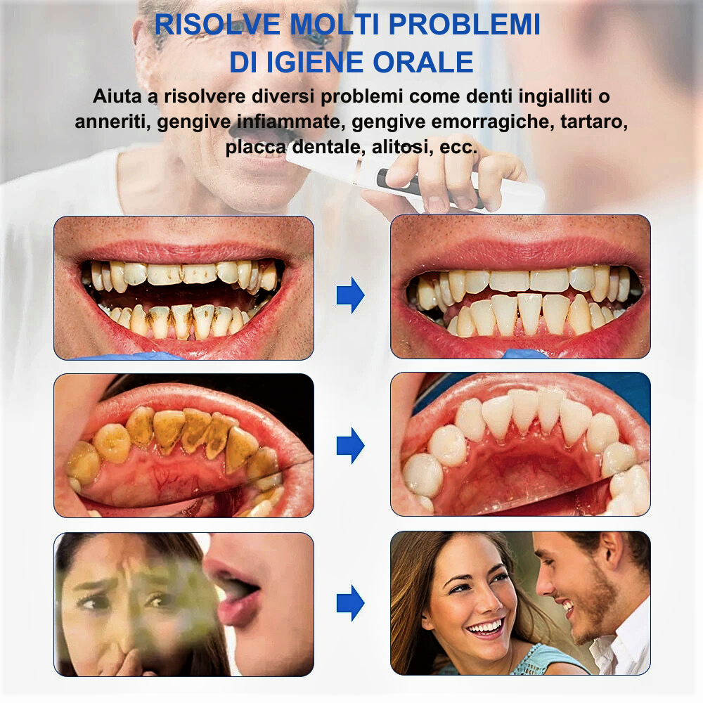 Raspador Ultrasónico Profesional El Dentista en Tu Casa
