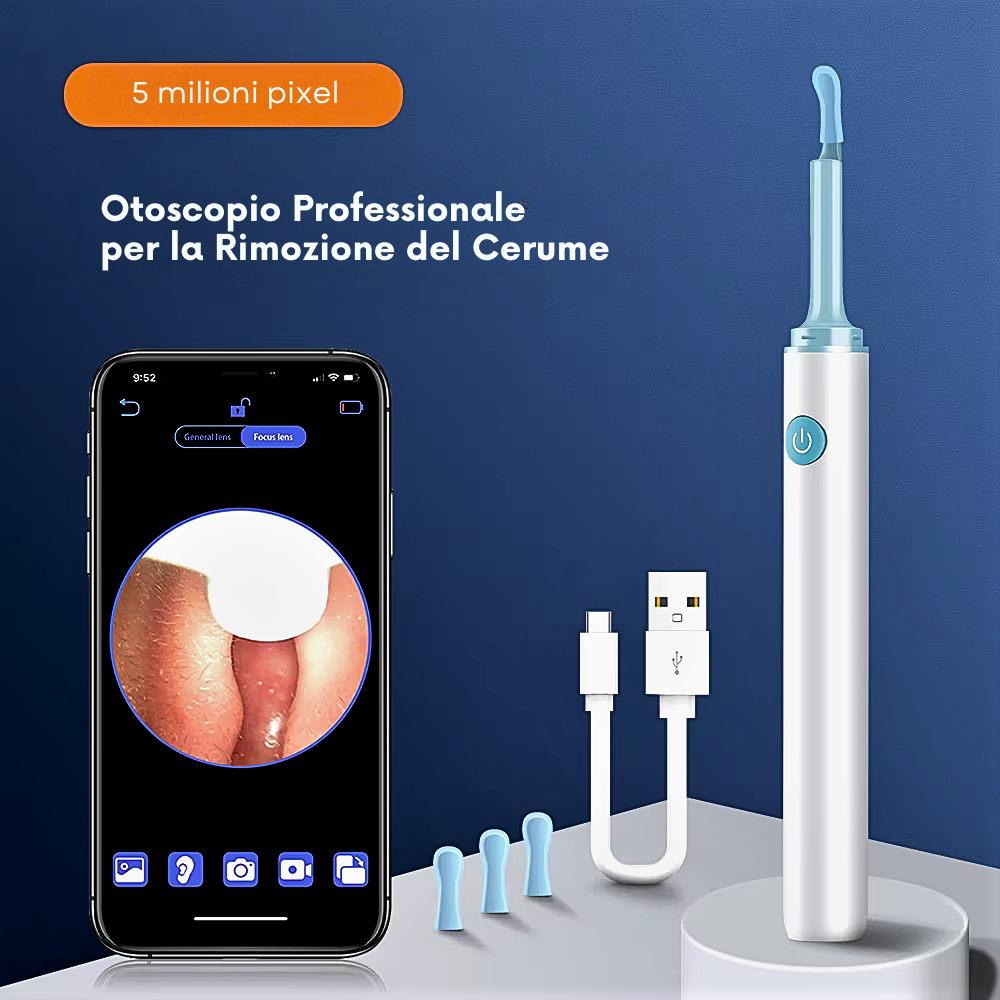 Otoscopio inteligente profesional: la nueva frontera de la higiene personal