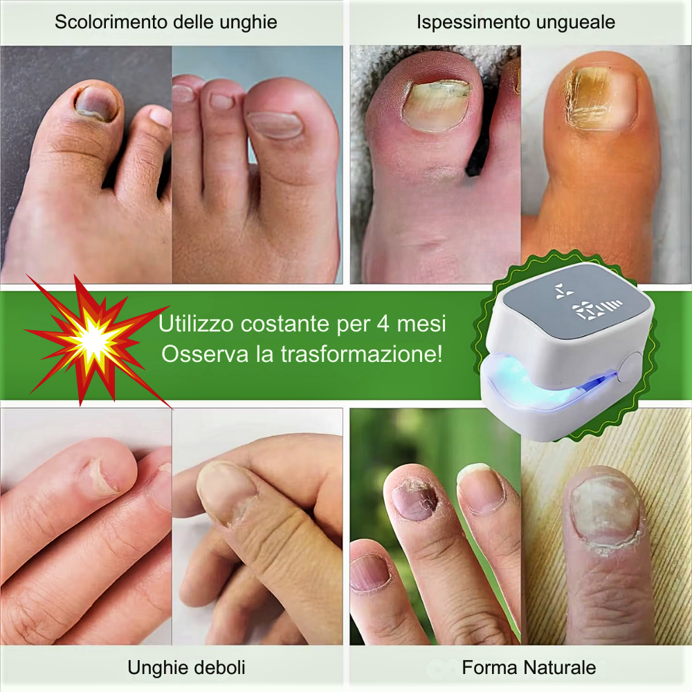 Dispositivo Professionale a LED Fotonici & Infrarossi – La Soluzione Avanzata per la Cura delle Unghie