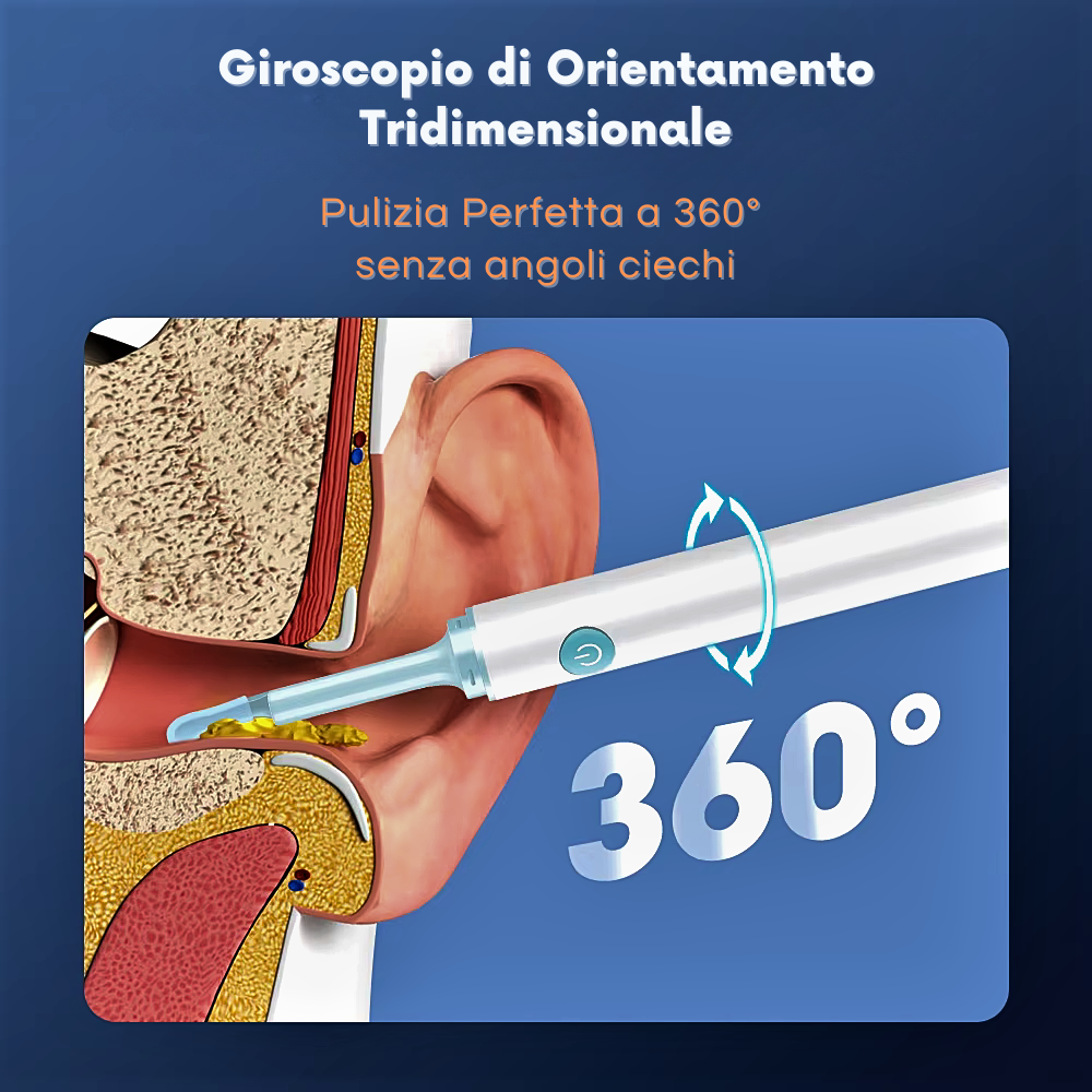 Otoscopio inteligente profesional: la nueva frontera de la higiene personal