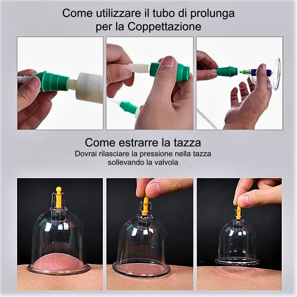 Set di Coppettazione Anti Cellulite: La Soluzione Naturale per una Pelle Più Liscia e Tonica