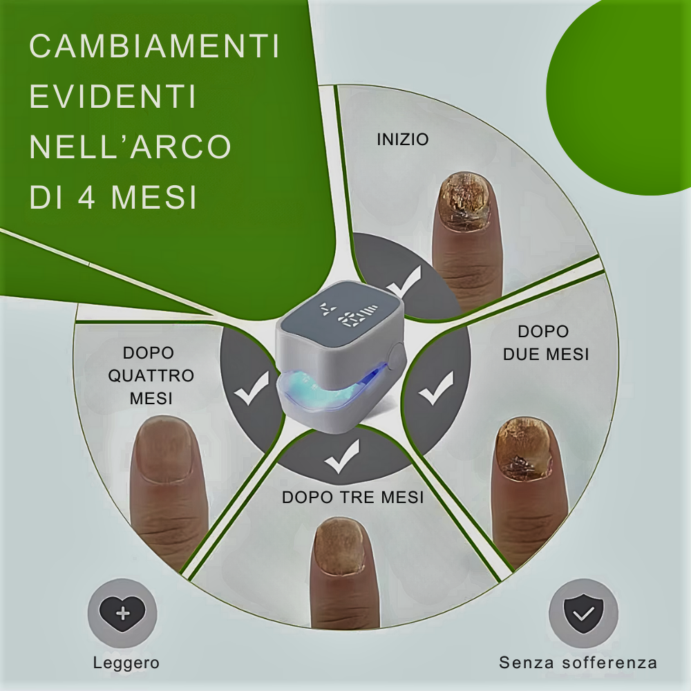 Dispositivo Professionale a LED Fotonici & Infrarossi – La Soluzione Avanzata per la Cura delle Unghie