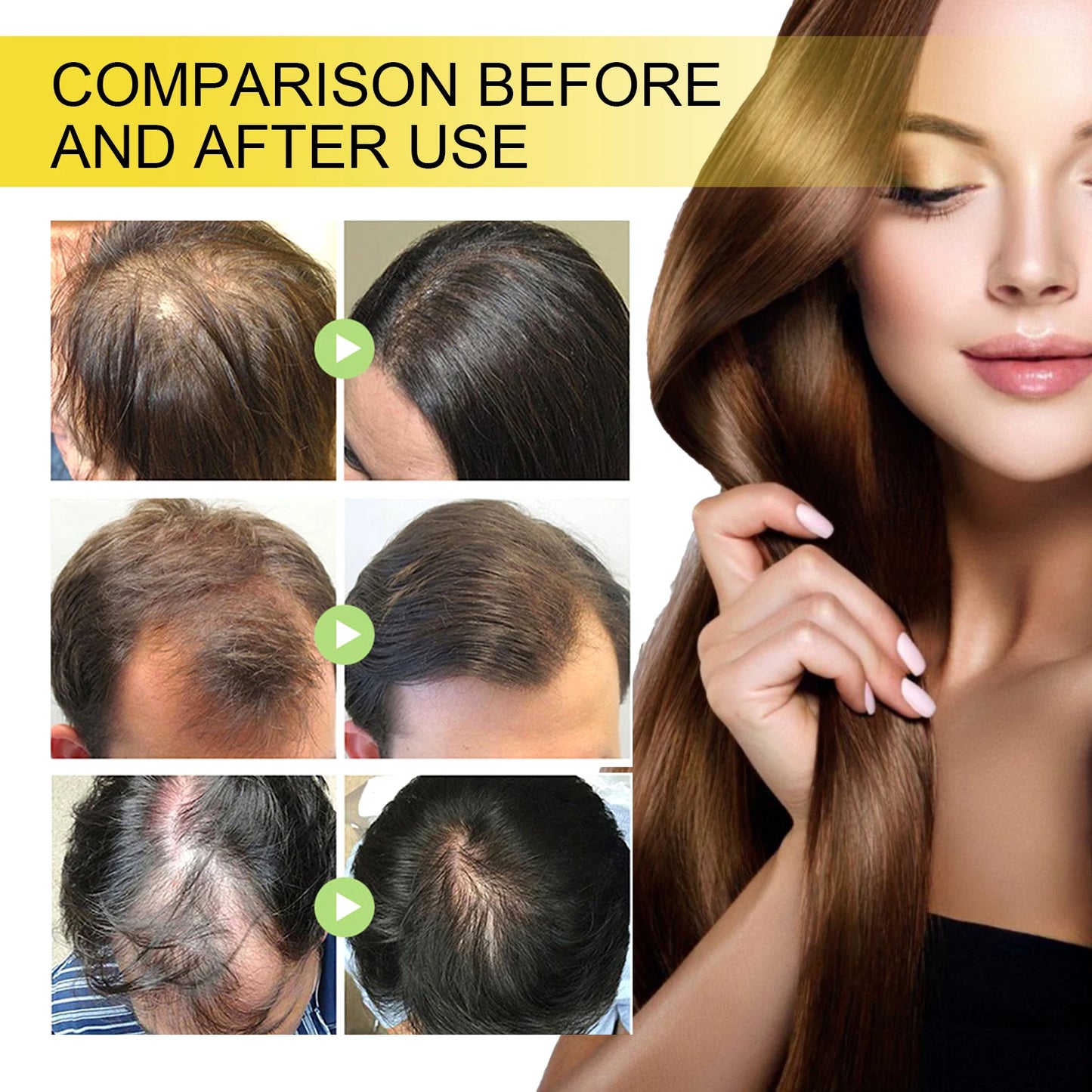 Hair Growth Essential Oil. Effectively Repair Baldness and Hair Loss Symptoms