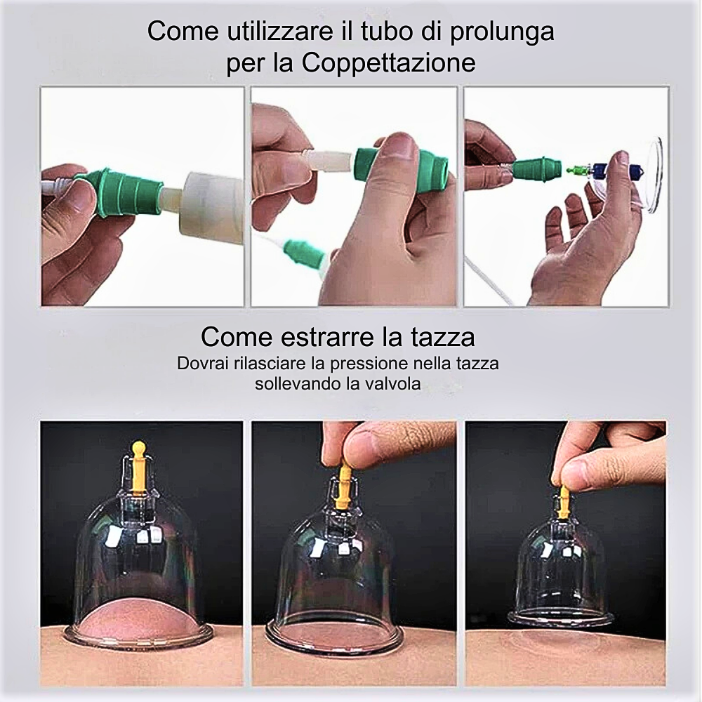 Set di Coppettazione Anti Cellulite