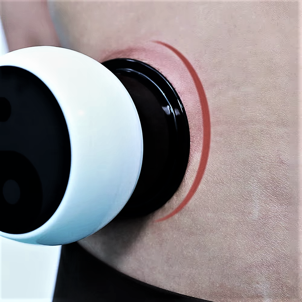 Dispositivo Elettronico 4 in 1 per Coppettazione Anticellulite