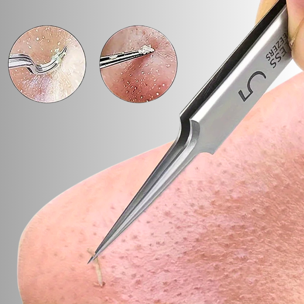 Set Gua Sha, Roller e Pinzetta