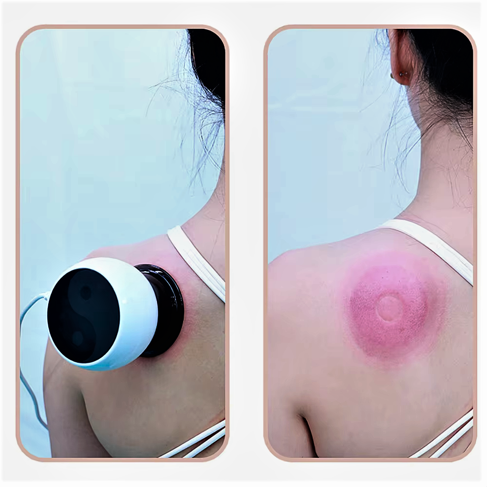 Dispositivo Elettronico 4 in 1 per Coppettazione Anticellulite