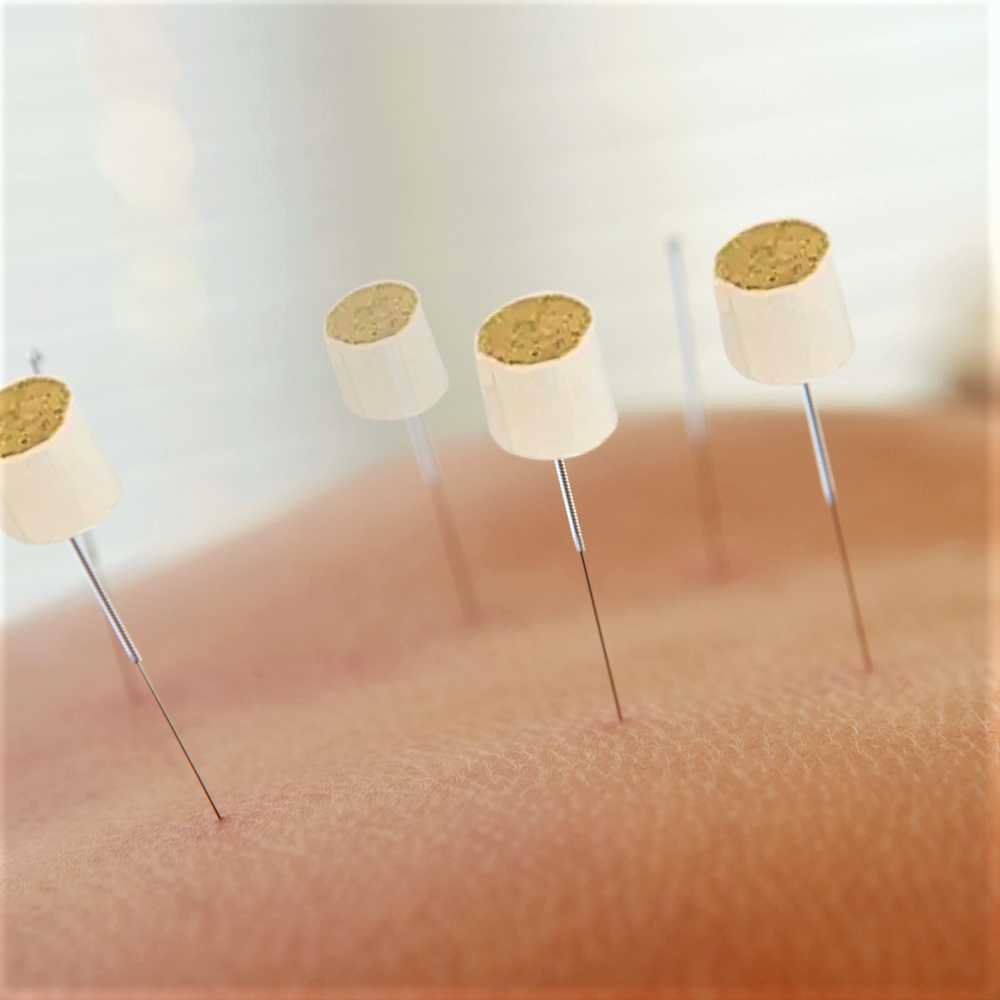 Mini Candele di Moxa per Agopuntura: Trattamento Sinergico per il Benessere Profondo