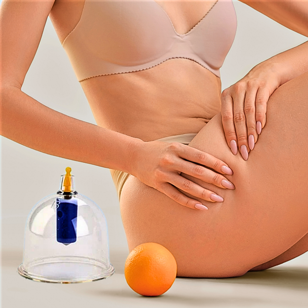 Set di Coppettazione Anti Cellulite