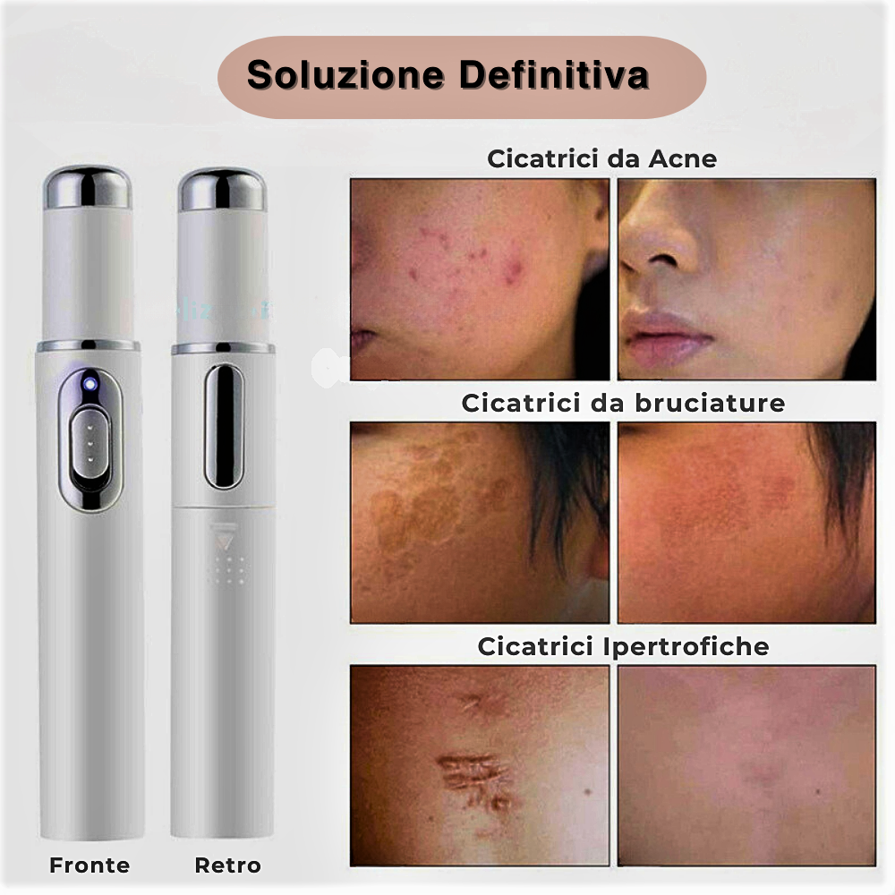 Penna a Luce Fotonica Blu