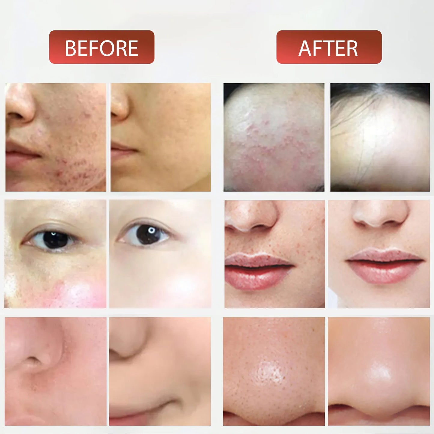 Maschera per Fotobiostimolazione per Viso e Corpo