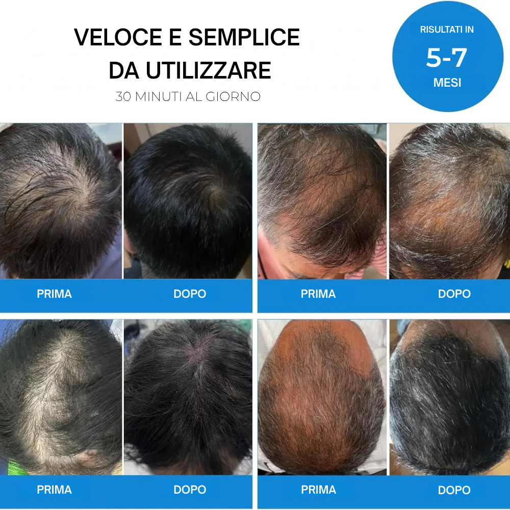 Dispositivo Professionale di Ricrescita con Tecnologia LLLT