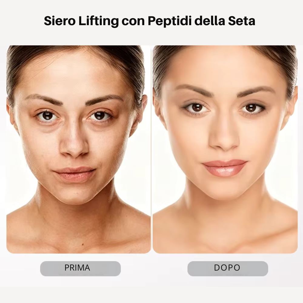 Siero Lifting con Peptidi della Seta e Collagene