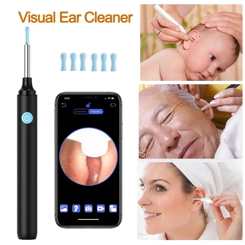 Smart Visual Ear Cleaner with Camera  Ear Sticks USB C Charging Ear Wax Removal Tool WIFI Connection 6 LED Lights Earpick