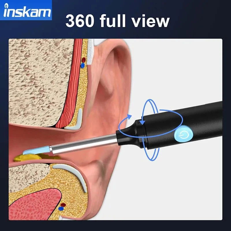 Smart Visual Ear Cleaner with Camera  Ear Sticks USB C Charging Ear Wax Removal Tool WIFI Connection 6 LED Lights Earpick
