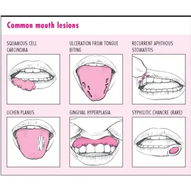 Red Light Therapy for Gum Sensitivity Professional Device for Inflammation Relief & Oral Health Improvement