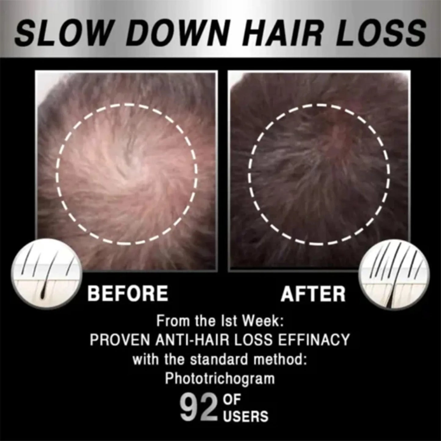 Mobile Hair Growth Cap, Hair Care, Promotes Hair Growth, Massages And Relaxes The Scalp, Relieves Stress And Hair Loss, 1pc