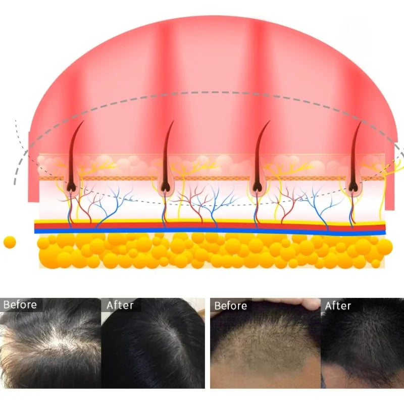 Medical Grade Laser Hair Cap 96 Diodes Professional Laser Therapy Hat for Hair Regrowth Men & Women Full Scalp Coverage