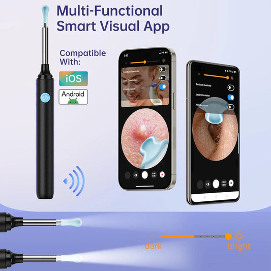 Smart Visual Ear Cleaner with Camera  Ear Sticks USB C Charging Ear Wax Removal Tool WIFI Connection 6 LED Lights Earpick