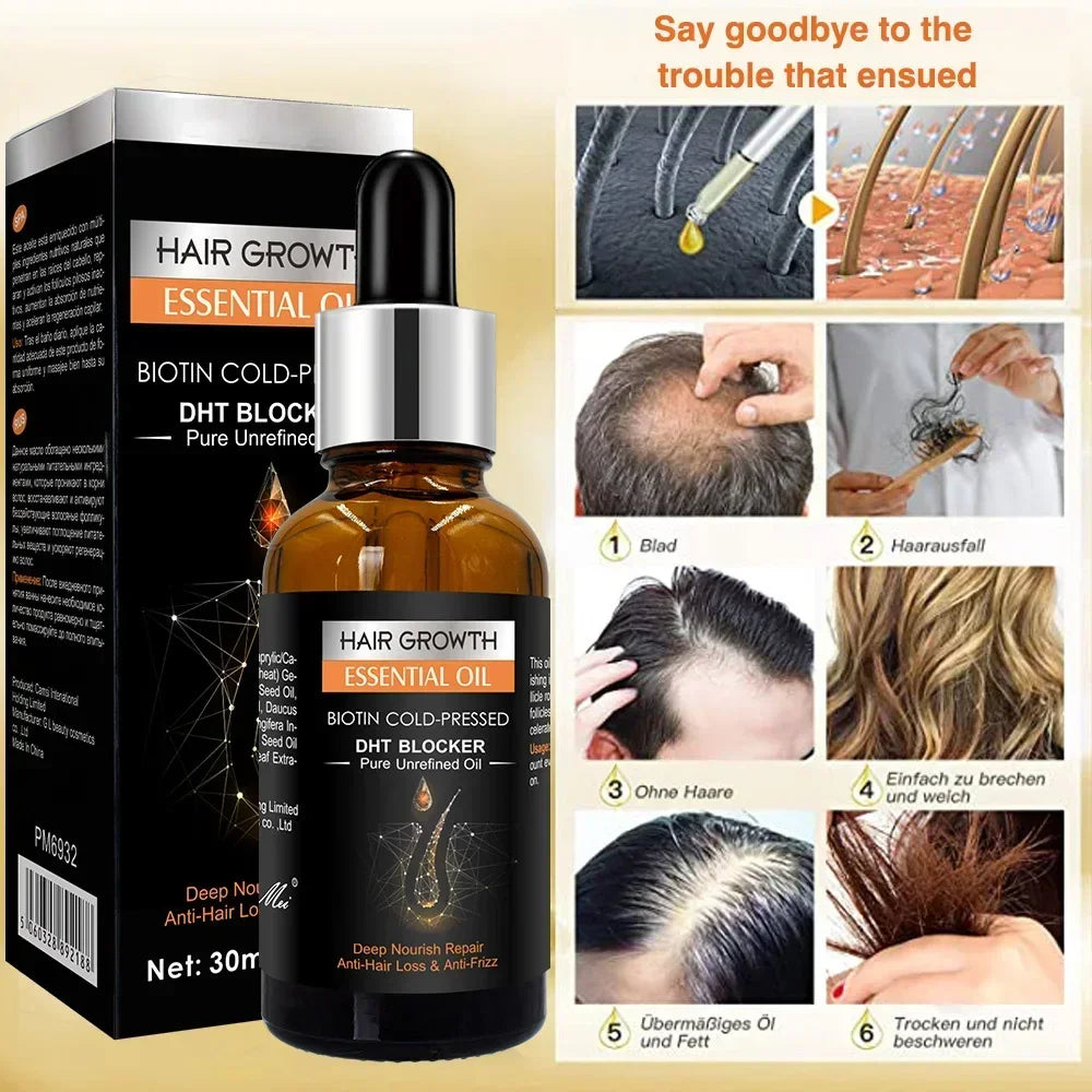 High Repurchase,Hair Growth Oil,Biotin DHT Blocker,Anti-Loss Shampoo,Boost Regrowth,Increase Production of Shampoo,hair Growth