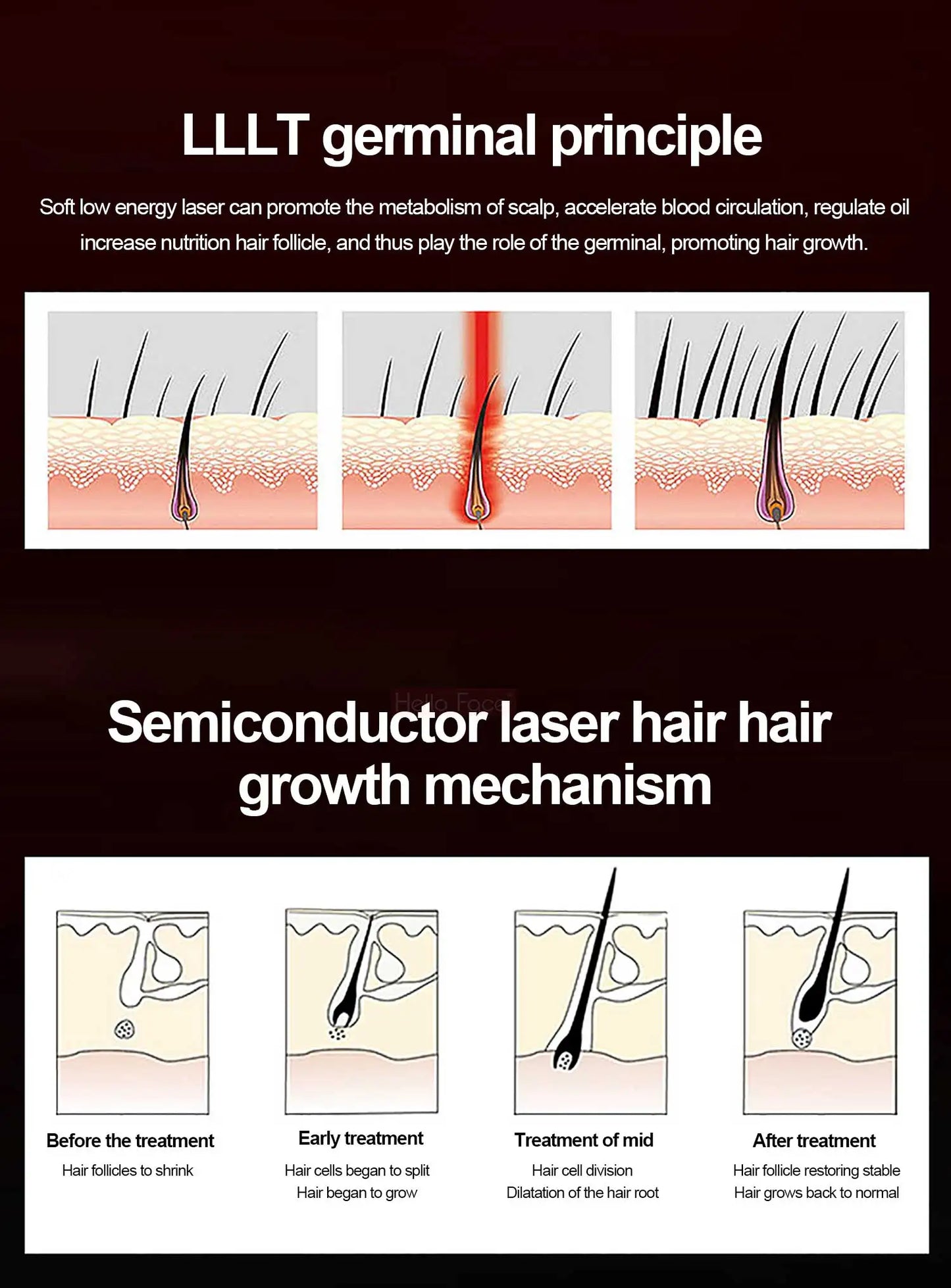 272 Laser Hair Growth Cap LLLT Therapy Red Light Scalp Health Device with Travel Bag for Hair Regrowth And Scalp Care