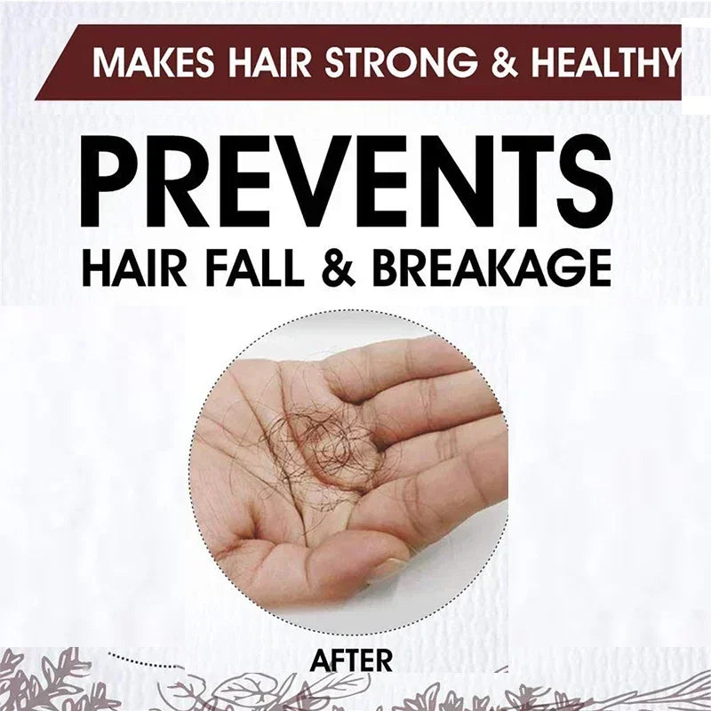 Hair Growth for Men Women Ginger Grow Hair Oil Care Anti Hair Loss Scalp Treatment Serum Products Beauty Health