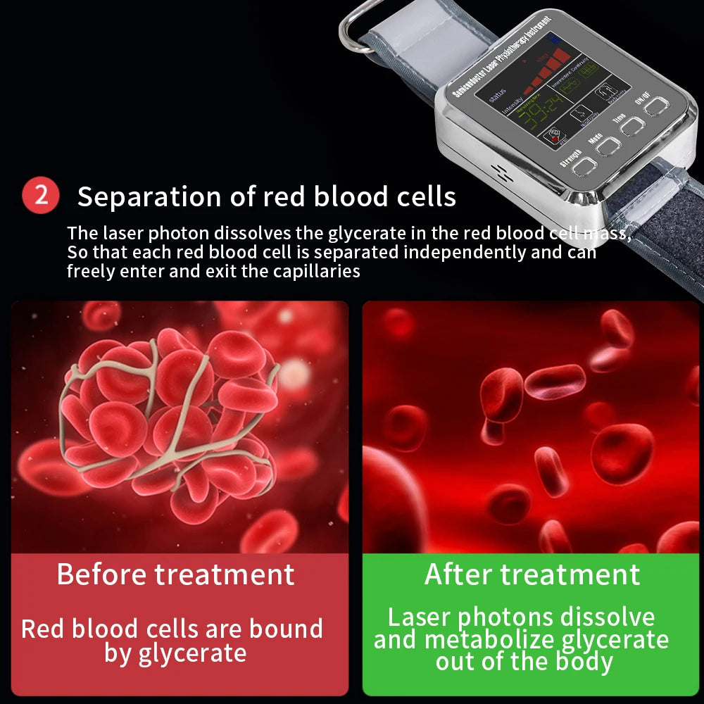 12-Hole Hypertension Laser Therapy Watch Semiconductor Blood Irradiation Treatment Instrument 650nm Acupuncture Points Watch