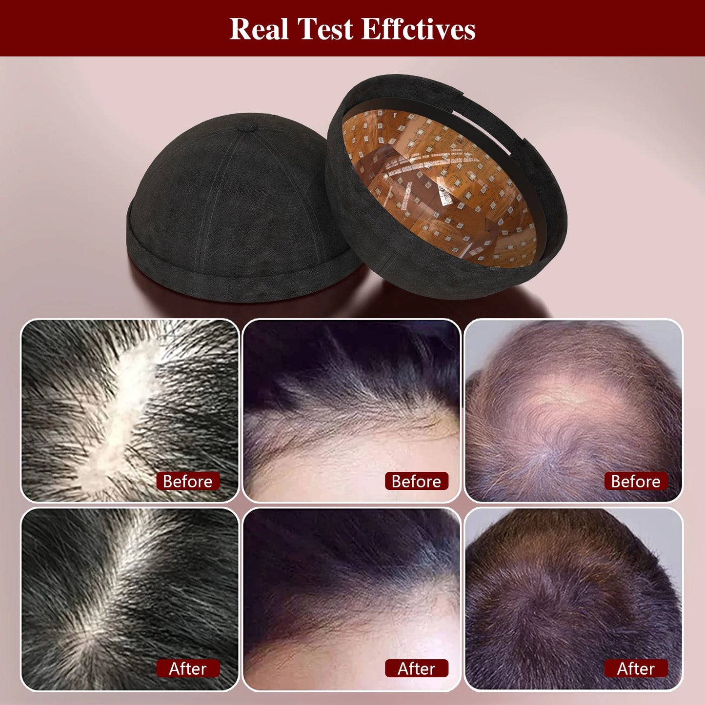 236 Diodes Laser Hair Growth Cap LLLT Therapy Anti Hair Loss Treatment Promote Hair Regrowth Device Restore Hair Thickness
