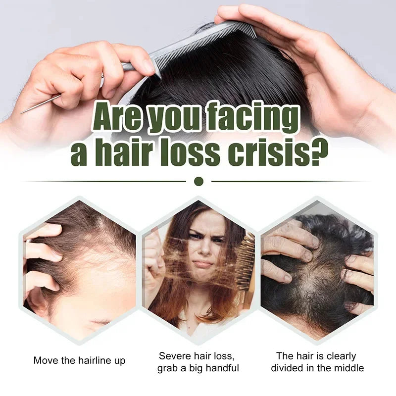 Hair Growth Oil Africa Crazy Traction Alopecia Serum Anti Hair Break Thicken Hair Loss Treatment Spray for Man Women 60ML