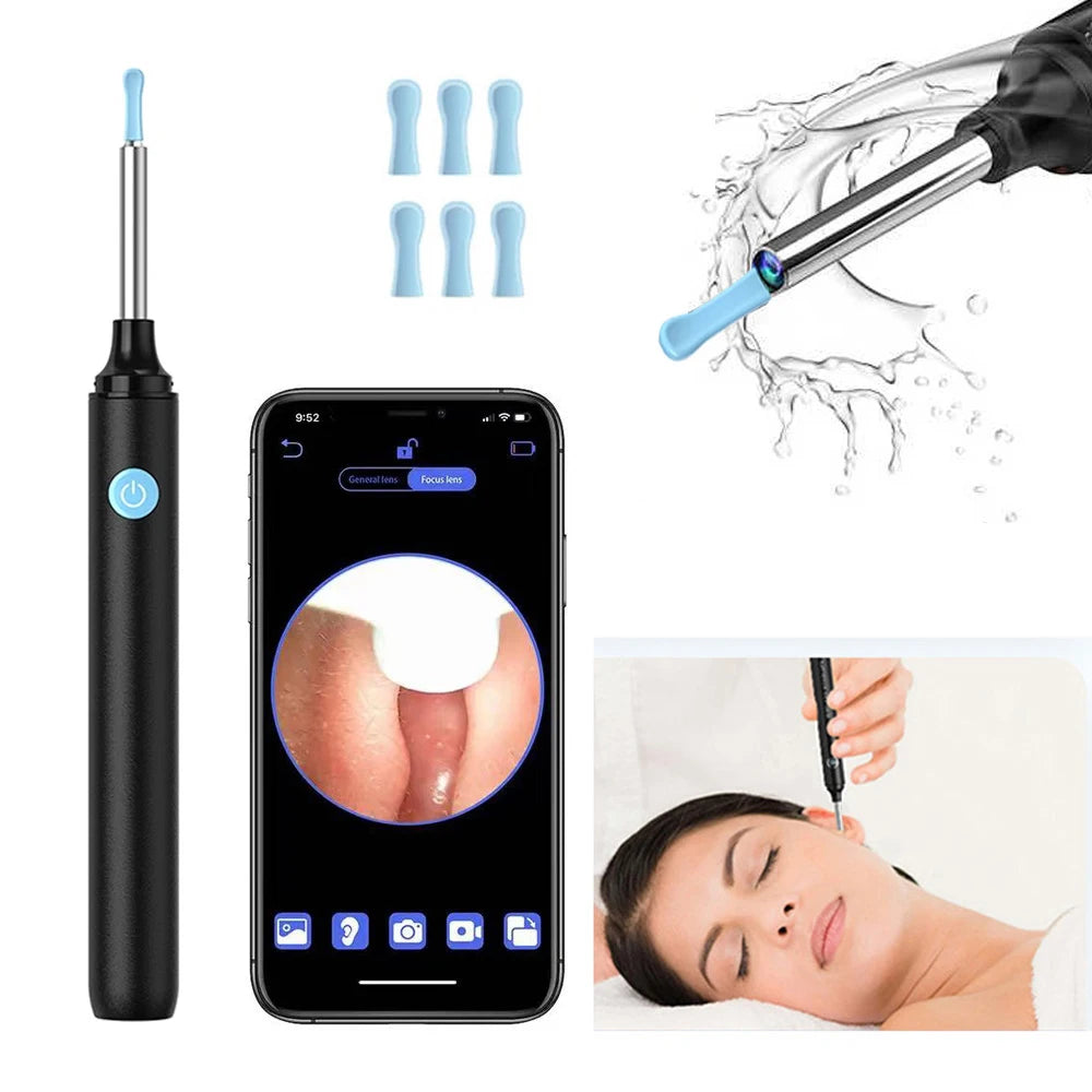 Smart Visual Ear Cleaner with Camera  Ear Sticks USB C Charging Ear Wax Removal Tool WIFI Connection 6 LED Lights Earpick