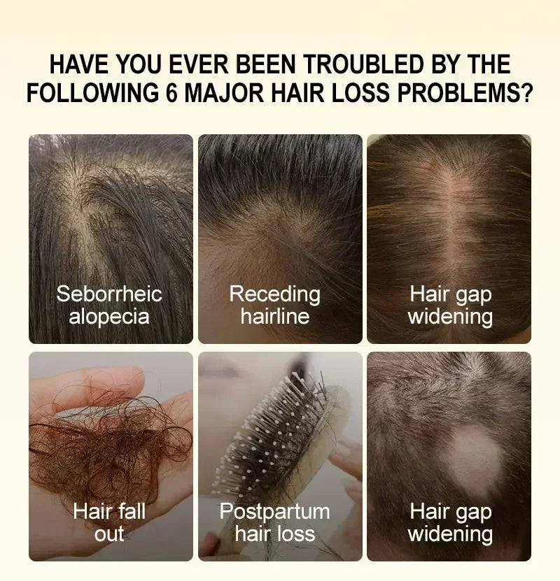 Hair Growth for Men Women Ginger Grow Hair Oil Care Anti Hair Loss Scalp Treatment Serum Products Beauty Health
