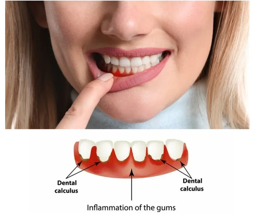 Red Light Therapy for Gum Sensitivity Professional Device for Inflammation Relief & Oral Health Improvement