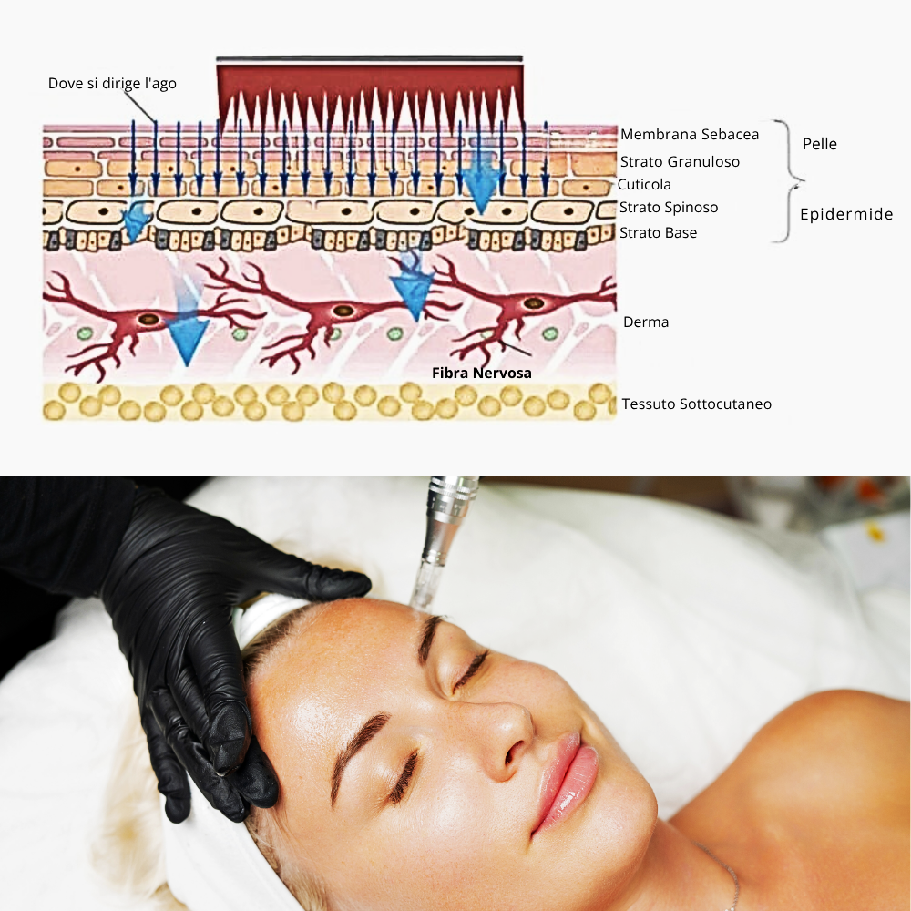 Penna Microneedling Pro a 7 LED Fotonici